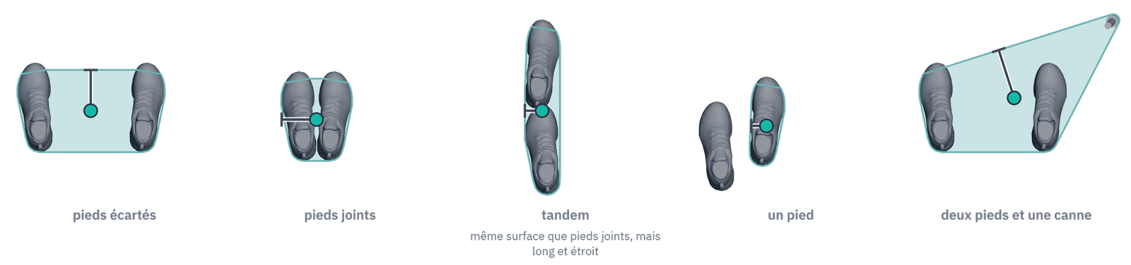 Le polygone de sustentation vu de dessus, pour cinq dispositions des appuis — pieds écartés, pieds joints, tandem, un pied, deux pieds et une canne —, avec la projection verticale du centre de masse et le segment de la marge.